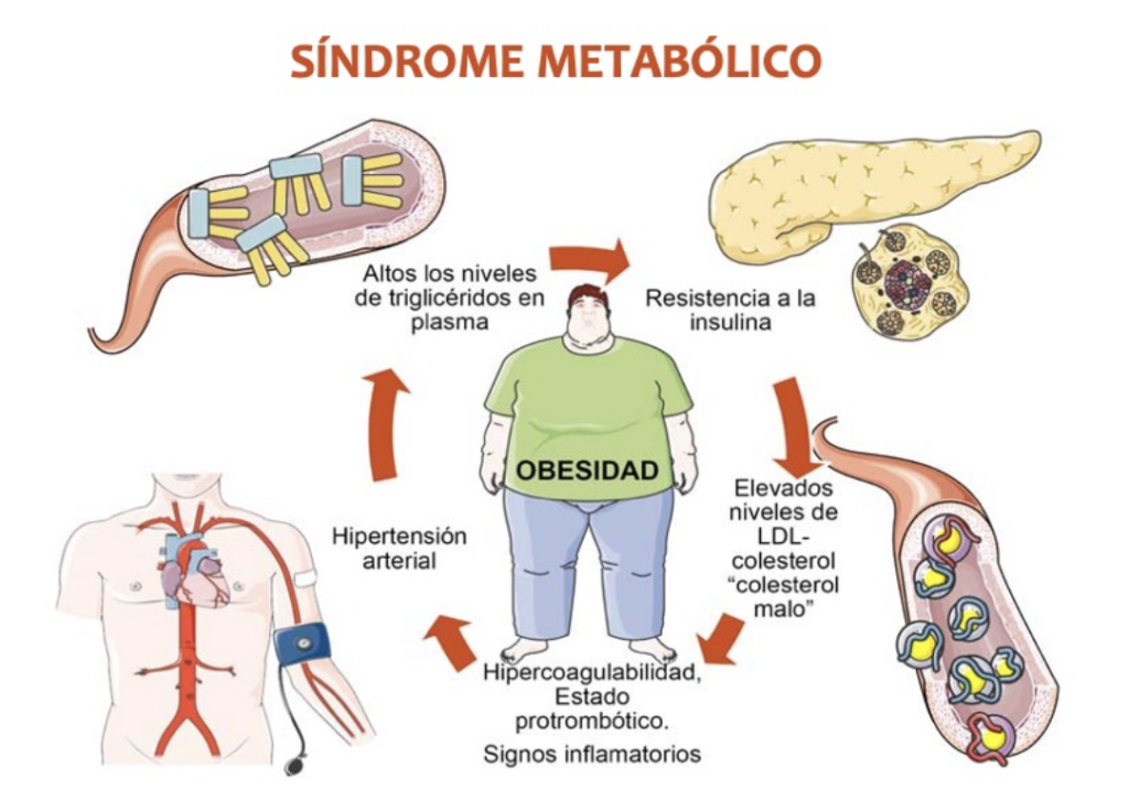 enfermedad-sindrome-metabolico-2