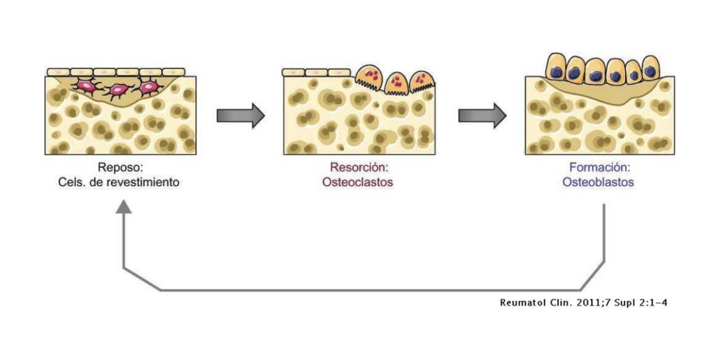 osteoporosis-2