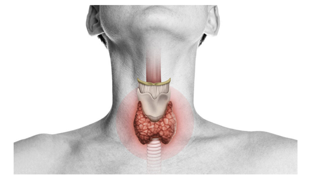 hipotiroidismo-1